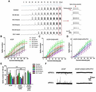 Compensatory Mechanisms Modulate the Neuronal Excitability in a Kainic Acid-Induced Epilepsy Mouse Model